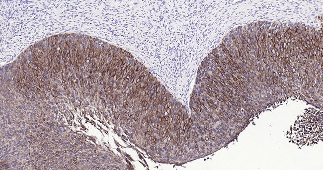 Cytokeratin Pan Type I/II Antibody in Immunohistochemistry (Paraffin) (IHC (P))