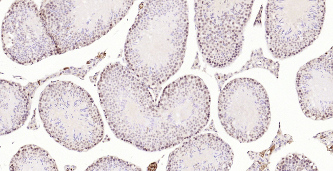 PMS2 Antibody in Immunohistochemistry (Paraffin) (IHC (P))