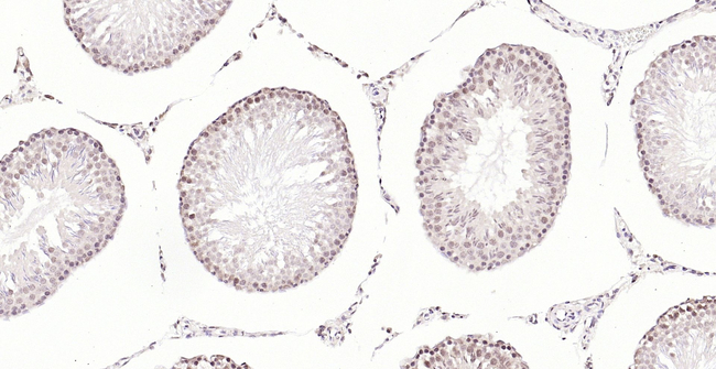 PMS2 Antibody in Immunohistochemistry (Paraffin) (IHC (P))