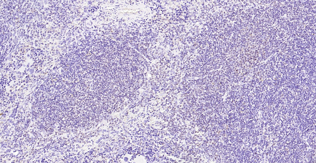Oct-2 Antibody in Immunohistochemistry (Paraffin) (IHC (P))