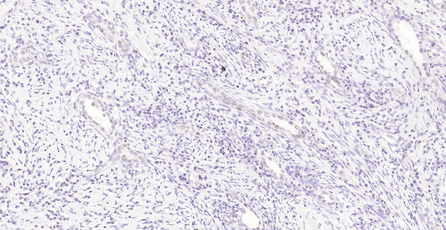 MLH1 Antibody in Immunohistochemistry (Paraffin) (IHC (P))