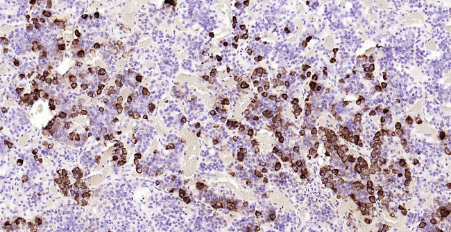 ACTH Antibody in Immunohistochemistry (Paraffin) (IHC (P))