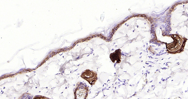 Cytokeratin 14 Antibody in Immunohistochemistry (Paraffin) (IHC (P))