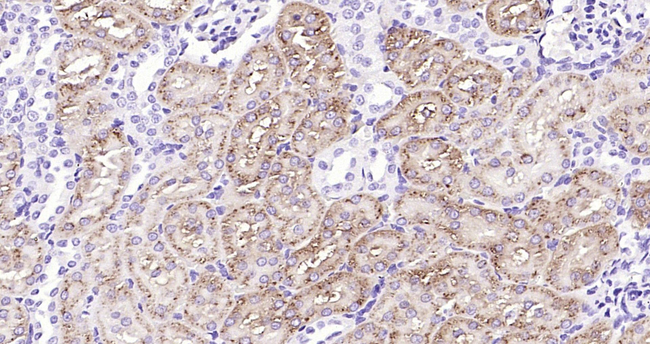 NAPSA Antibody in Immunohistochemistry (Paraffin) (IHC (P))