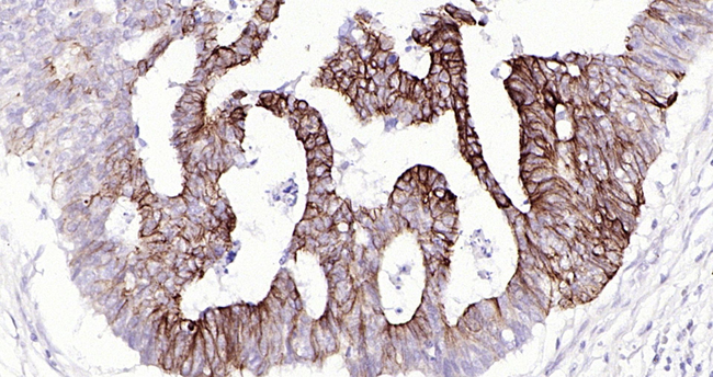 Cytokeratin 20 Antibody in Immunohistochemistry (Paraffin) (IHC (P))