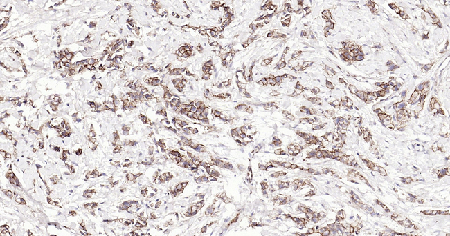 delta Catenin Antibody in Immunohistochemistry (Paraffin) (IHC (P))