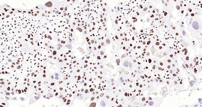 p57 Kip2 Antibody in Immunohistochemistry (Paraffin) (IHC (P))