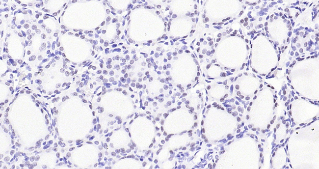 Nkx2.1 Antibody in Immunohistochemistry (Paraffin) (IHC (P))