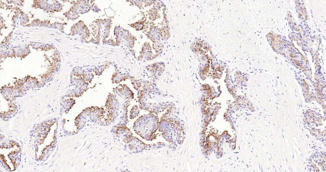 Prostate Specific Acid Phosphatase Antibody in Immunohistochemistry (Paraffin) (IHC (P))