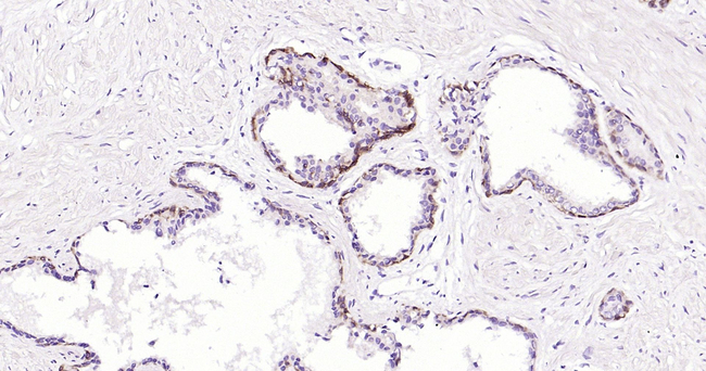 Cytokeratin 5 Antibody in Immunohistochemistry (Paraffin) (IHC (P))