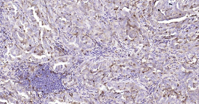 Stathmin 1 Antibody in Immunohistochemistry (Paraffin) (IHC (P))