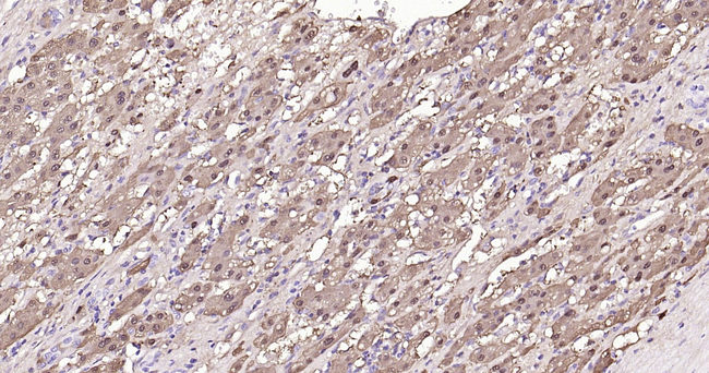 Arginase 1 Antibody in Immunohistochemistry (Paraffin) (IHC (P))