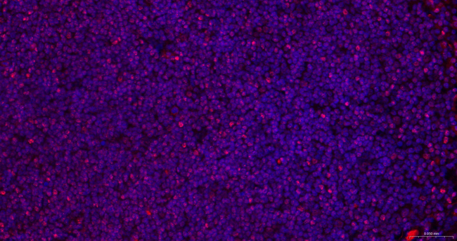 MUM1 Antibody in Immunohistochemistry (Paraffin) (IHC (P))