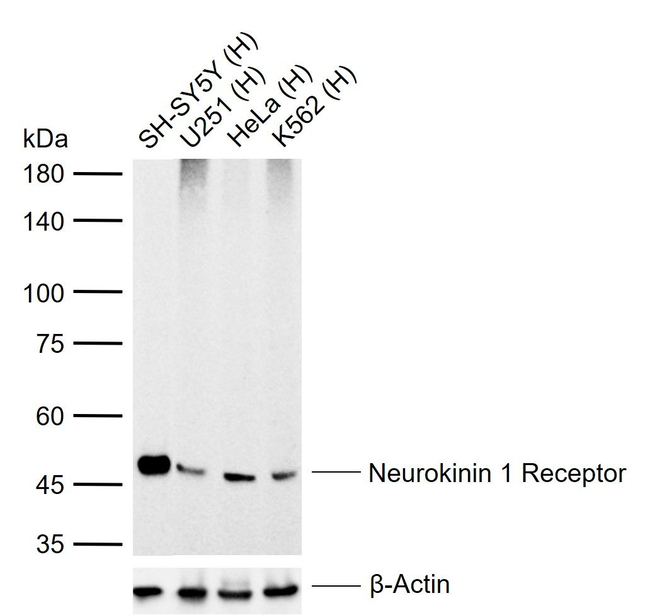 TACR1 Antibody in Western Blot (WB)