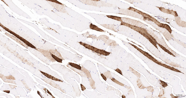 Myoglobin Antibody in Immunohistochemistry (Paraffin) (IHC (P))