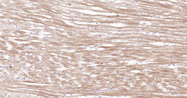 Cardiac Troponin I Antibody in Immunohistochemistry (Paraffin) (IHC (P))