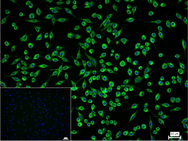 NF-L Antibody in Immunocytochemistry (ICC/IF)