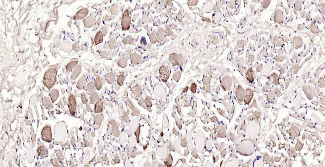 Myoglobin Antibody in Immunohistochemistry (Paraffin) (IHC (P))