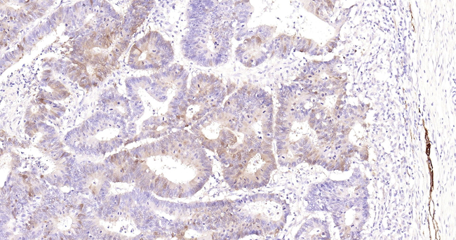 PGP9.5 Antibody in Immunohistochemistry (Paraffin) (IHC (P))