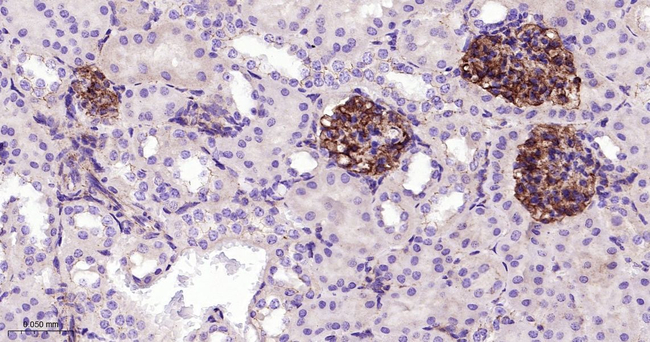 ZO-1 Antibody in Immunohistochemistry (Paraffin) (IHC (P))