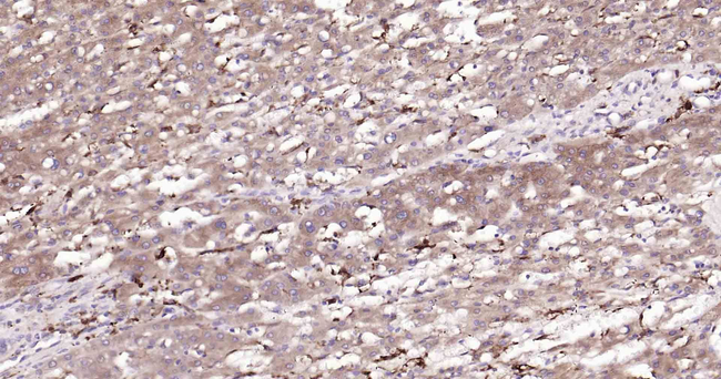 Beclin 1 Antibody in Immunohistochemistry (Paraffin) (IHC (P))