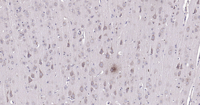 beta Amyloid (1-42) Antibody in Immunohistochemistry (Paraffin) (IHC (P))