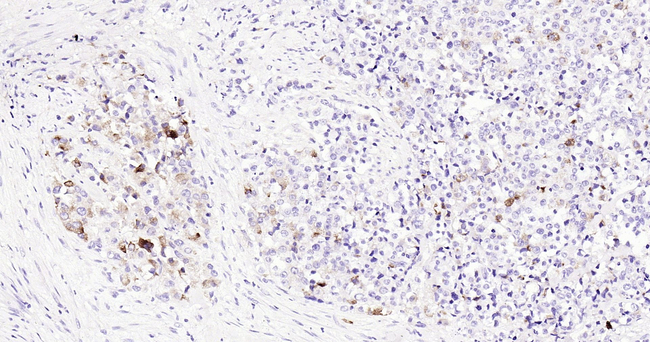 PSA Antibody in Immunohistochemistry (Paraffin) (IHC (P))