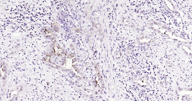 MUC1 Antibody in Immunohistochemistry (Paraffin) (IHC (P))