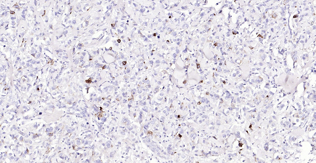 MUC1 Antibody in Immunohistochemistry (Paraffin) (IHC (P))