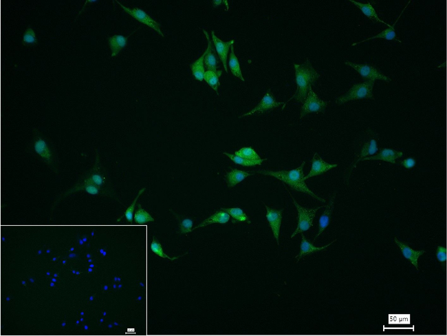 alpha Synuclein Antibody in Immunocytochemistry (ICC/IF)