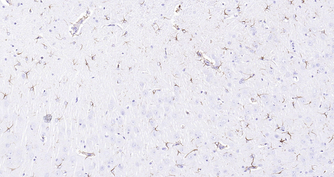 GFAP Antibody in Immunohistochemistry (Paraffin) (IHC (P))