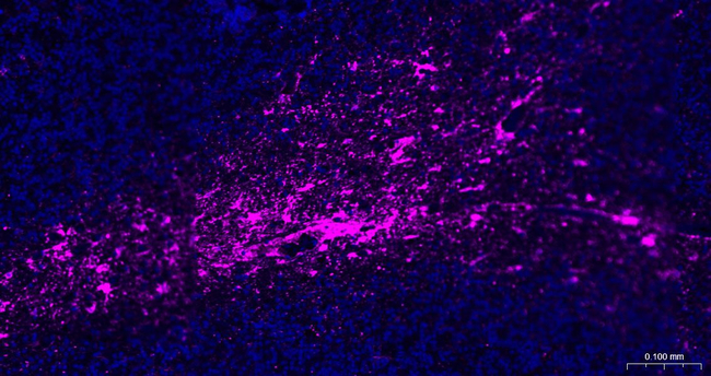 GFAP Antibody in Immunohistochemistry (Paraffin) (IHC (P))