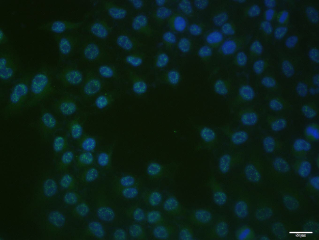 c-Jun Antibody in Immunocytochemistry (ICC/IF)