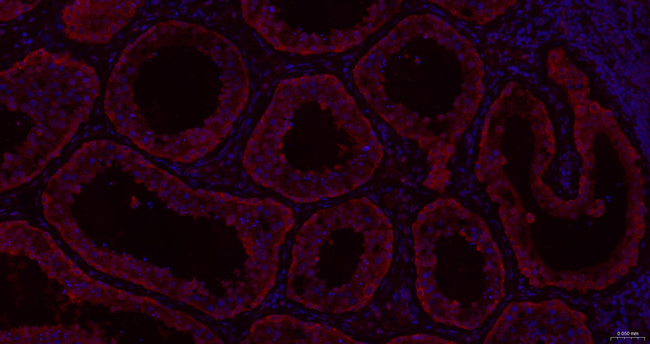 MYO7A Antibody in Immunohistochemistry (Paraffin) (IHC (P))