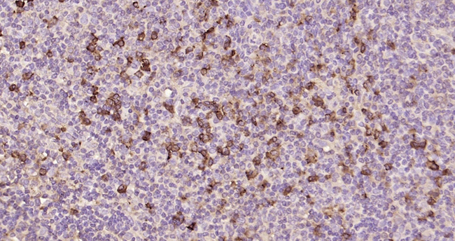 Lambda light chain Antibody in Immunohistochemistry (Paraffin) (IHC (P))