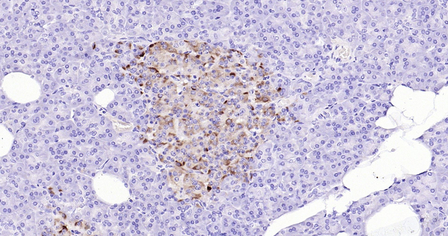 TIMP1 Antibody in Immunohistochemistry (Paraffin) (IHC (P))
