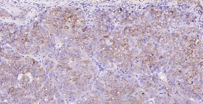 RBP4 Antibody in Immunohistochemistry (Paraffin) (IHC (P))