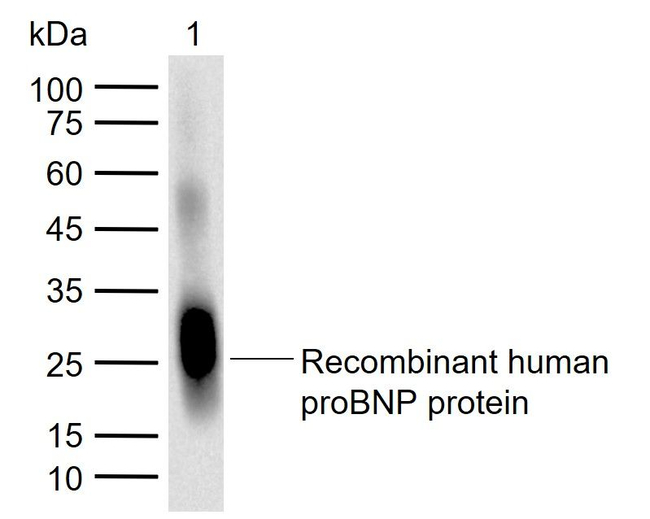 pro-Brain Natriuretic Peptide Antibody in Western Blot (WB)