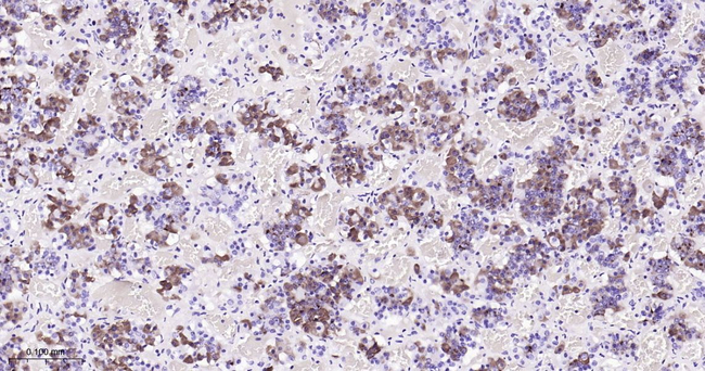 Prolactin Antibody in Immunohistochemistry (Paraffin) (IHC (P))
