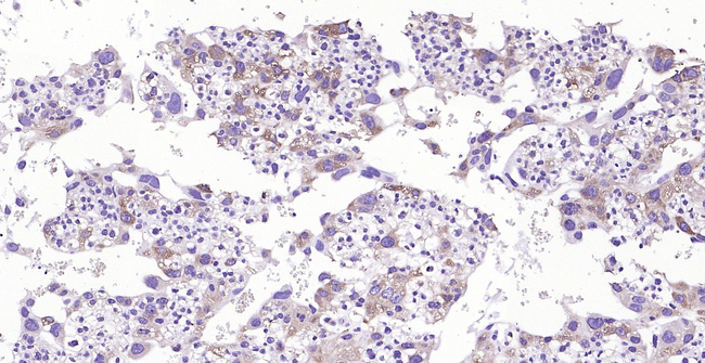 GC Antibody in Immunohistochemistry (Paraffin) (IHC (P))
