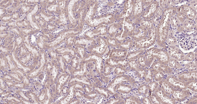 IGFBP3 Antibody in Immunohistochemistry (Paraffin) (IHC (P))