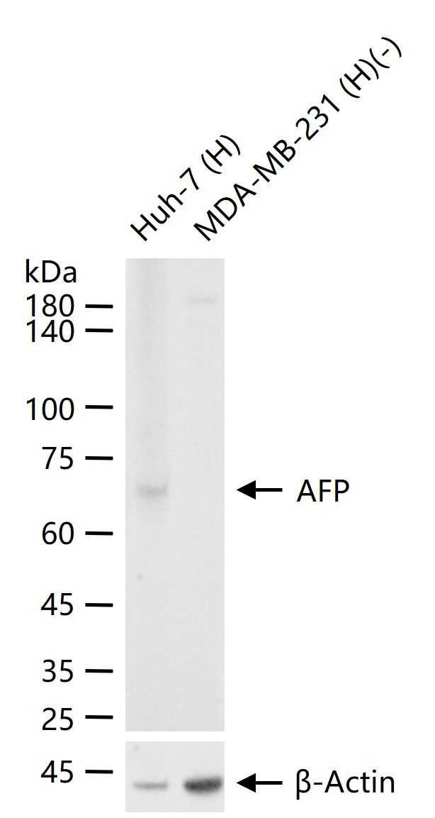 AFP Monoclonal Antibody (4C12) (MA571778)