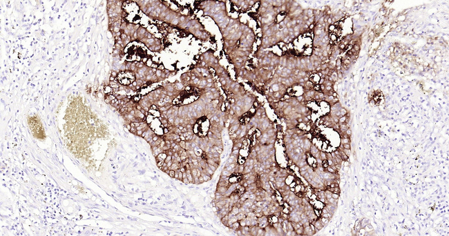 CEACAM5 Antibody in Immunohistochemistry (Paraffin) (IHC (P))