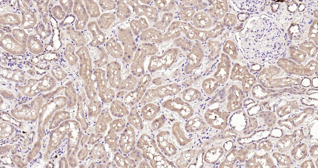 Renin Antibody in Immunohistochemistry (Paraffin) (IHC (P))