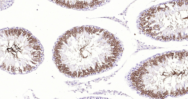 WFDC2 Antibody in Immunohistochemistry (Paraffin) (IHC (P))