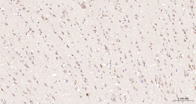 PR3 Antibody in Immunohistochemistry (Paraffin) (IHC (P))