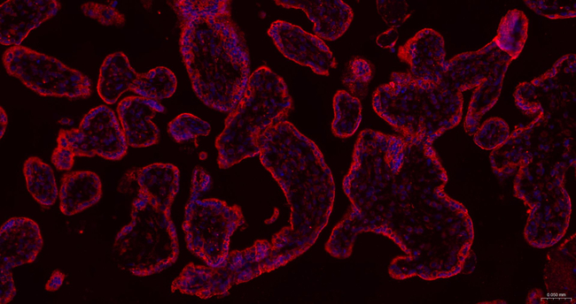 hCG beta Antibody in Immunohistochemistry (Paraffin) (IHC (P))