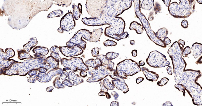 hCG beta Antibody in Immunohistochemistry (Paraffin) (IHC (P))