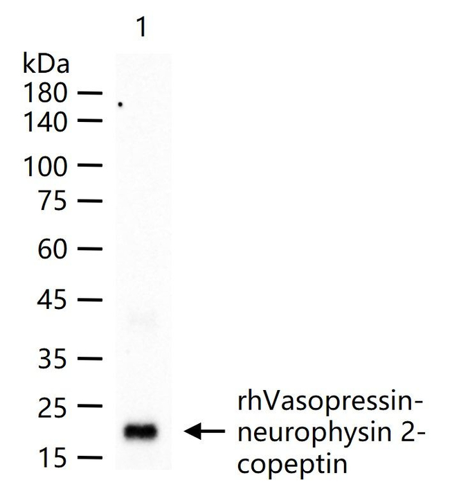 AVP Antibody in Western Blot (WB)