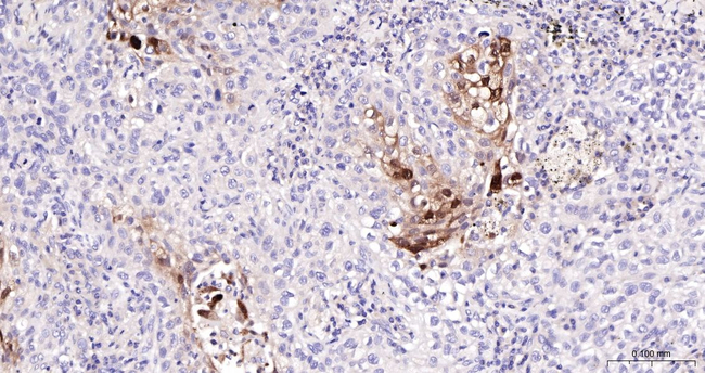 SERPINB3 Antibody in Immunohistochemistry (Paraffin) (IHC (P))